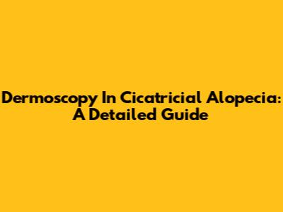 Dermoscopy In Cicatricial Alopecia: A Detailed Guide